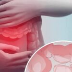 Guía completa para la salud intestinal: Alimentos fermentados, prebióticos y la recuperación del microbioma