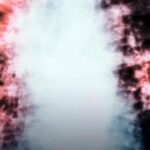 El cáncer de pulmón es cada vez más común entre personas que nunca han fumado, y esta podría ser la razón.