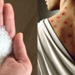 Conium maculatum: El peligro de la hiedra venenosa en su jardín