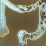 Desintoxicación Exprés: Limpia tu Colon en Menos de una Semana con Este Dúo Natural