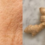 ¡Descubre el secreto para eliminar las verrugas de forma natural y para siempre!