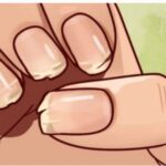 ¿Se te están pelando y rompiendo las uñas? ¡Tu cuerpo te está pidiendo ayuda!