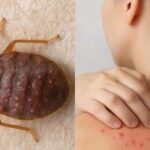 Cómo eliminar las chinches de cama de tu jardín en minutos 🕷️