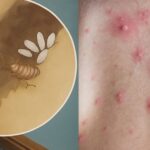 Elimina las chinches: Aprovecha el poder del aceite de clavo para revitalizar tu hogar