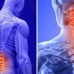 Fibromialgia y Dolor de Espalda: Cómo Aliviarla en Minutos